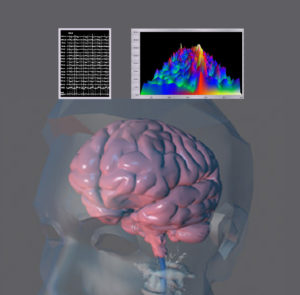 Clear-Brain & EEG